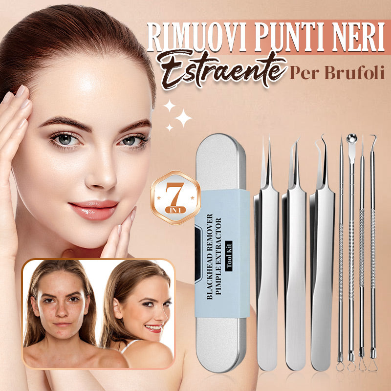Come Rimuovere Brufoli E Punti Neri Con Un Estrattore Di Comedoni - Foto 7